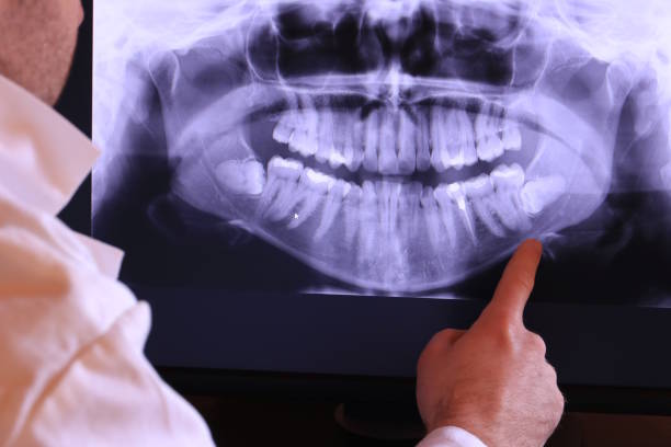 Best Emergency Dental Care for Broken or Chipped Teeth in Gananda, NY